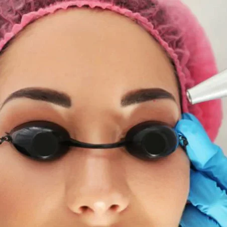 Permanent makeup removal Milton Keynes Permanent makeup removal Milton Keynes Art Laser Clinic Milton Keynes